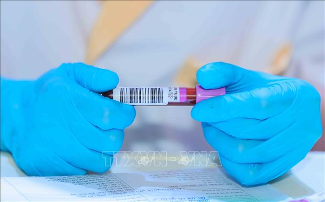 Quy trình thu nhận mẫu sinh phẩm ADN được thực hiện chặt chẽ, bảo đảm chính xác và an toàn. Ảnh: Phan Phương-TTXVN